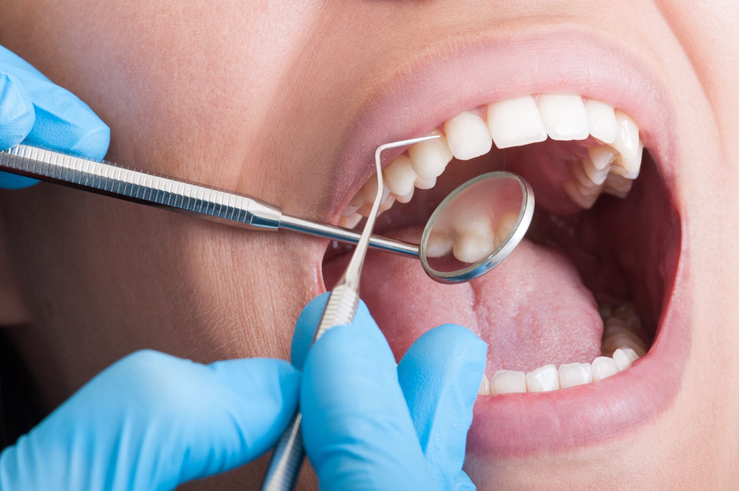 Top 10 de los errores más comunes que están poniendo en riesgo tu salud bucal
