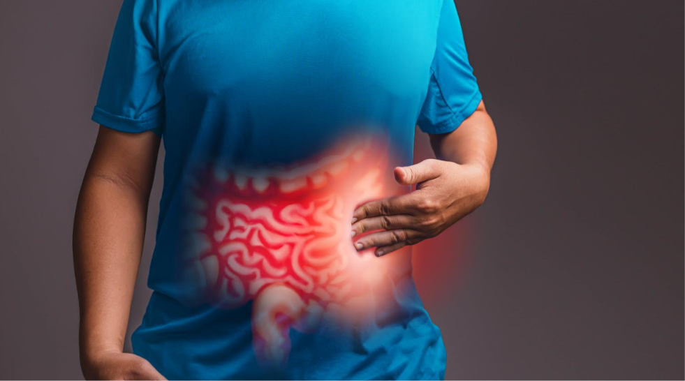 Cáncer colorrectal al alza en Chile: el test FIT ayuda a detectarlo a tiempo y los estudios genéticos a tratarlo mejor